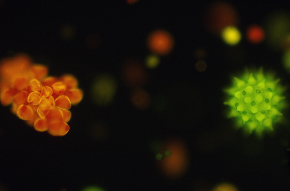 Microscopic image of mixed pollen with fluorescent lighting