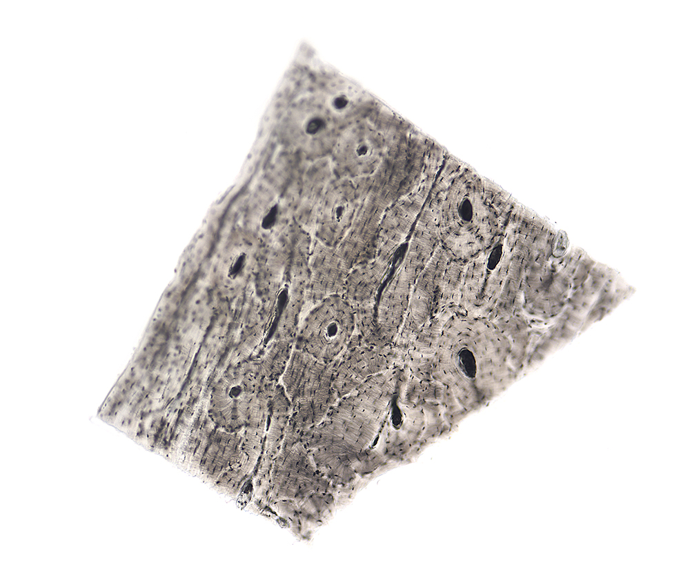 A piece of bone picture under the microscope