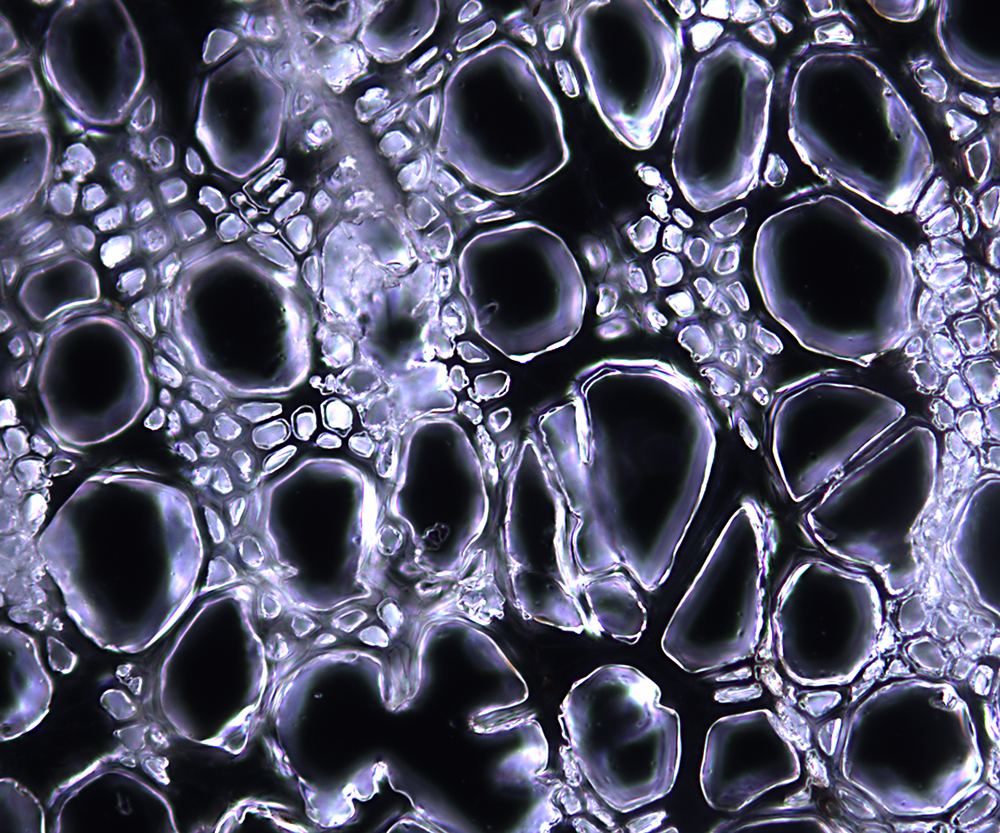 Microscopic image of silberweide under dark field
