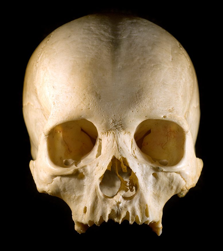 Human skull picture