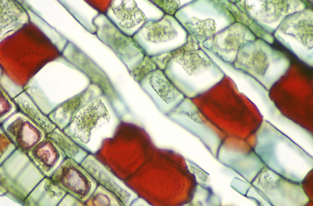 Microscopic image of a woody stem cell